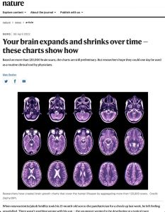 Your Brain Expands and Shrinks Over Time – These Charts Show How